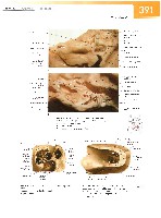 Sobotta Atlas of Human Anatomy  Head,Neck,Upper Limb Volume1 2006, page 398